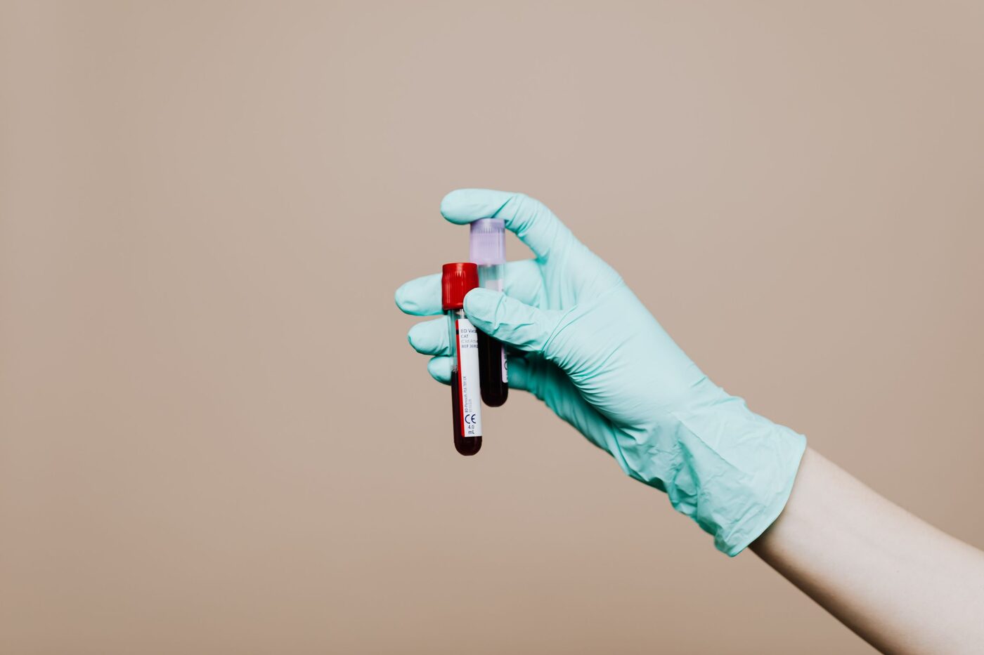 A gloved hand holding a single labelled blood collection tube against a plain background.